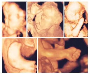 Morfologia fetala – asigurarea unui bebe sanatos