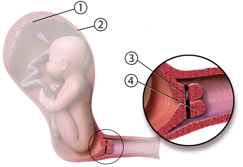 osteocondroza colului uterin și a brațului